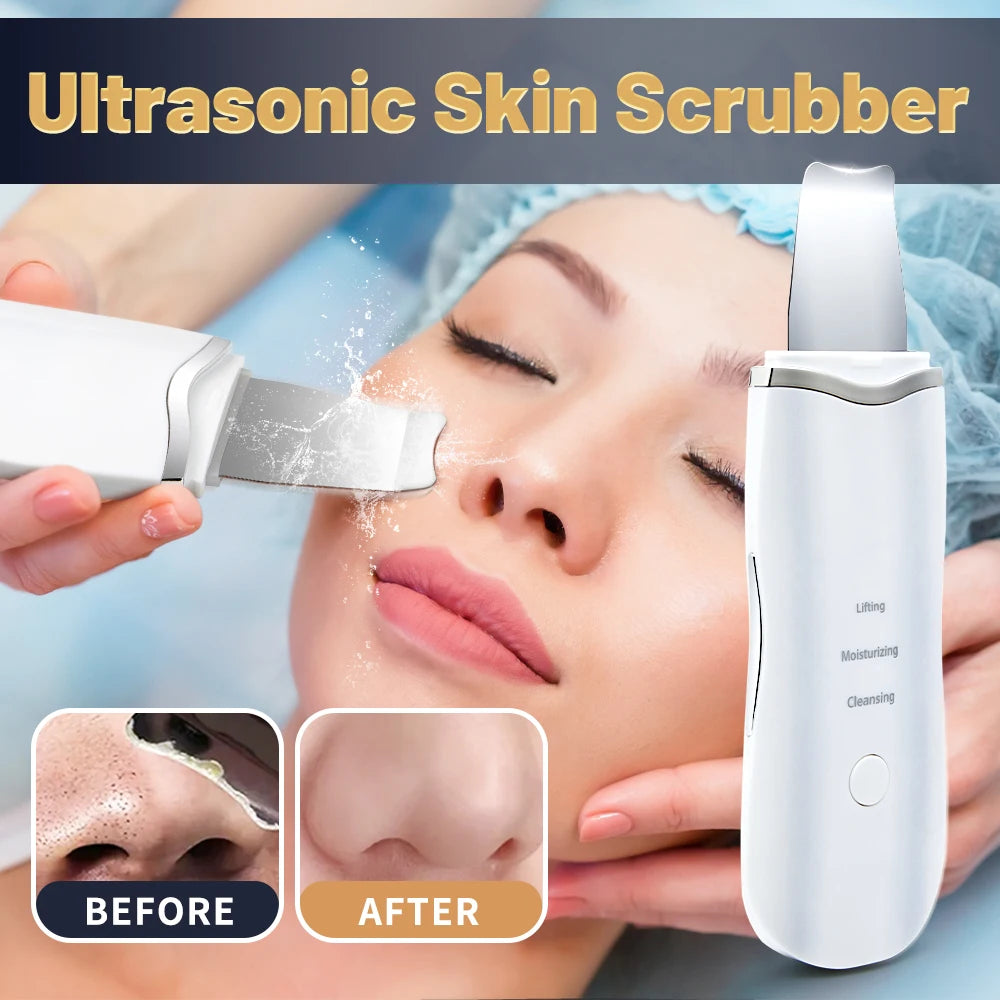 Skin scrubber ultrasonique visage – Nettoyeur de pores & points noirs professionnel